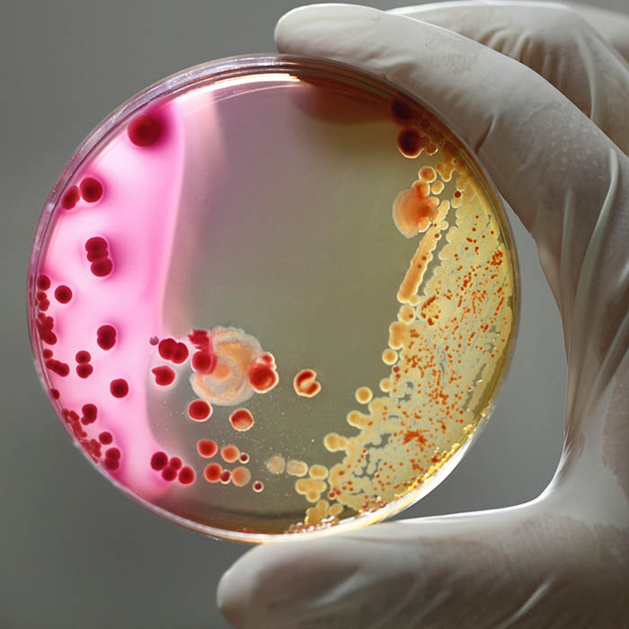 Biohazard Cleaning Milton Keynes